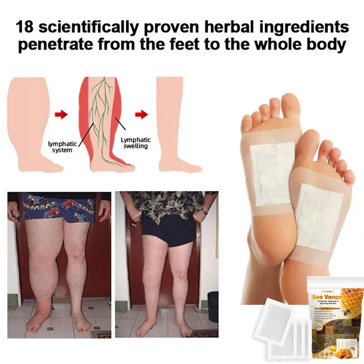 Bee Venom Lymphatic Drainage & Slimming Foot Patches ๐ฟ๐ฃ โ Buy 1 Get 1 Free!