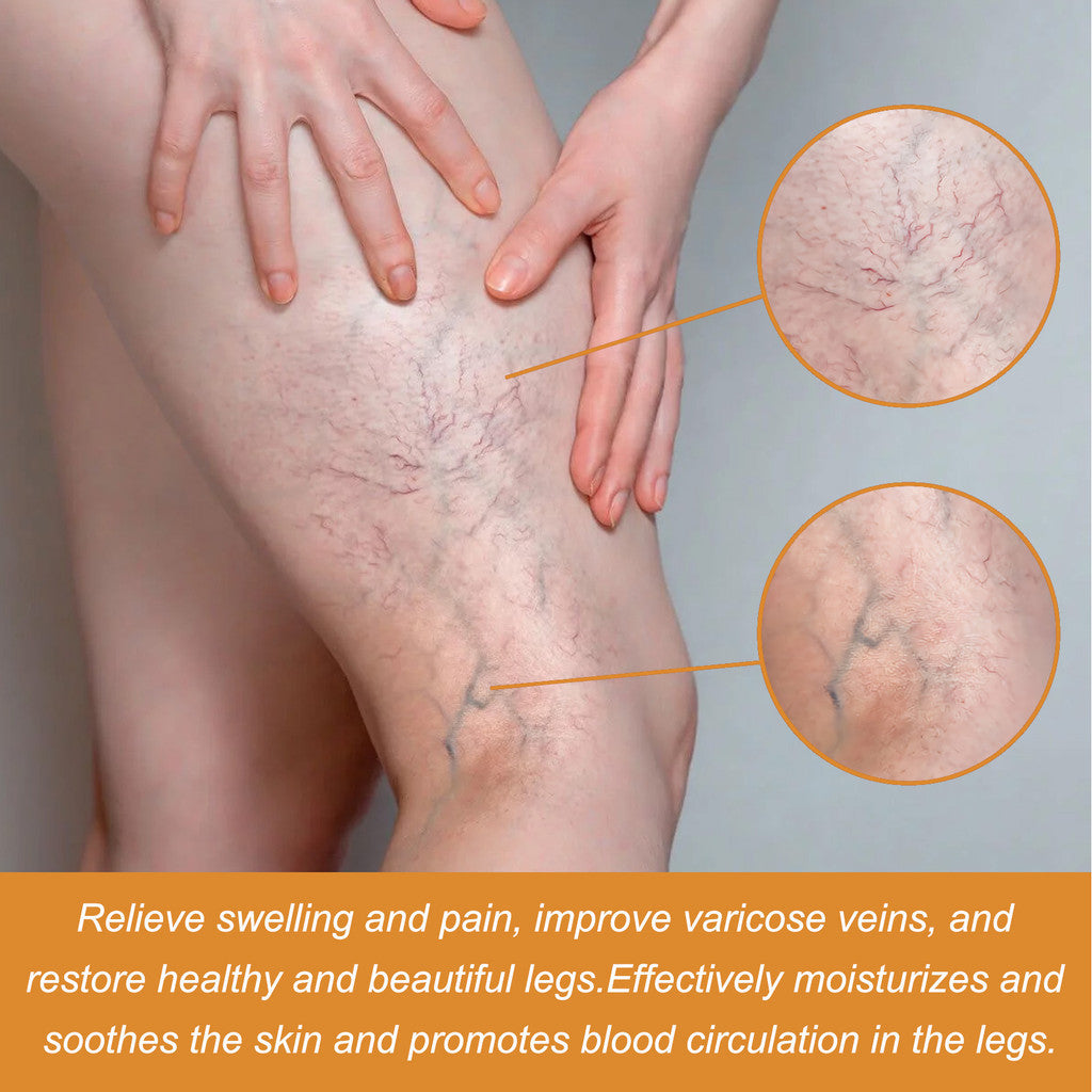 VeinVeda™ Varicose Vein Relief Spray ( BUY 1 GET 2 FREE )