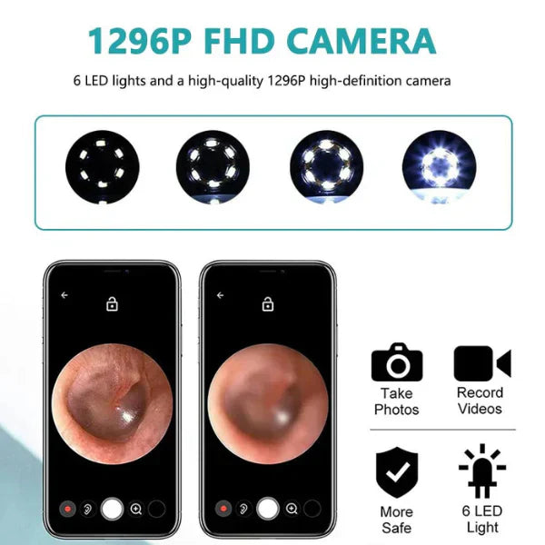 HD Wireless Ear Wax Cleaner Kit with Camera