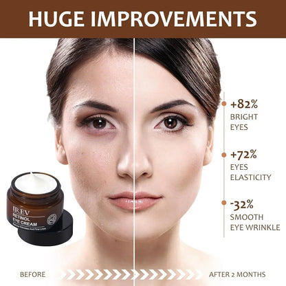 Retinol Eye Cream (BUY 1 GET 1 FREE)