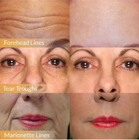 POLYPEPTIDE FIRMING FULL FACE CREAM-CHANGE FOR BEAUTIFUL SKIN WITHIN 2 WEEKS (BUY 1 GET 1 FREE)