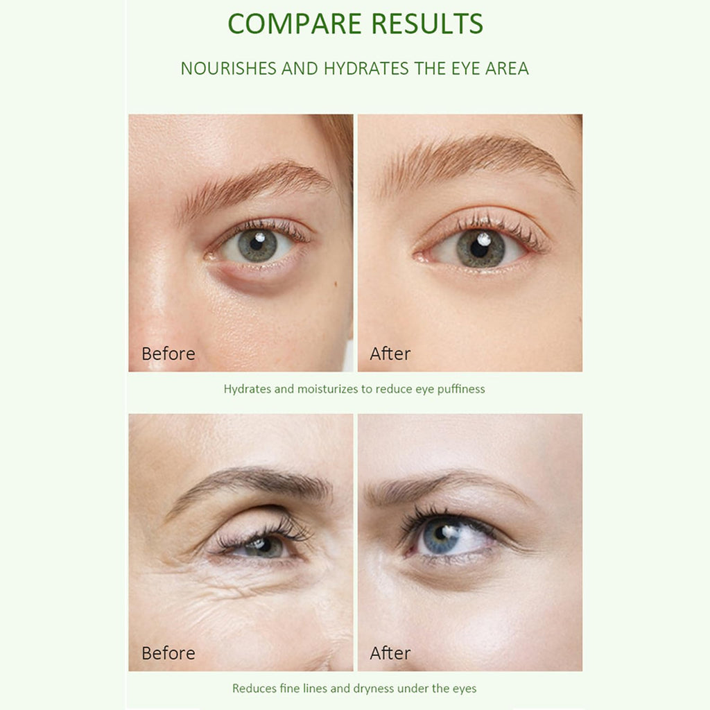 Aloe Vera Eye Serum (30ml) – ✨ Fades Eye Dark Circles, Wrinkles & Fine Line