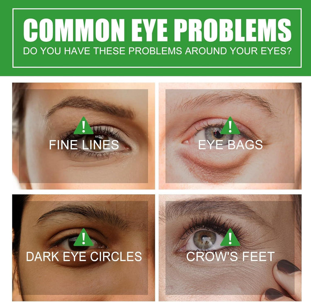 Aloe Vera Eye Serum (30ml) – ✨ Fades Eye Dark Circles, Wrinkles & Fine Line