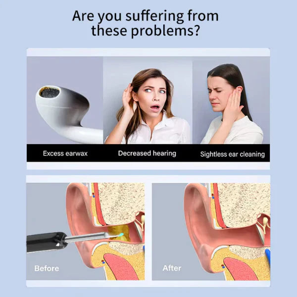 HD Wireless Ear Wax Cleaner Kit with Camera