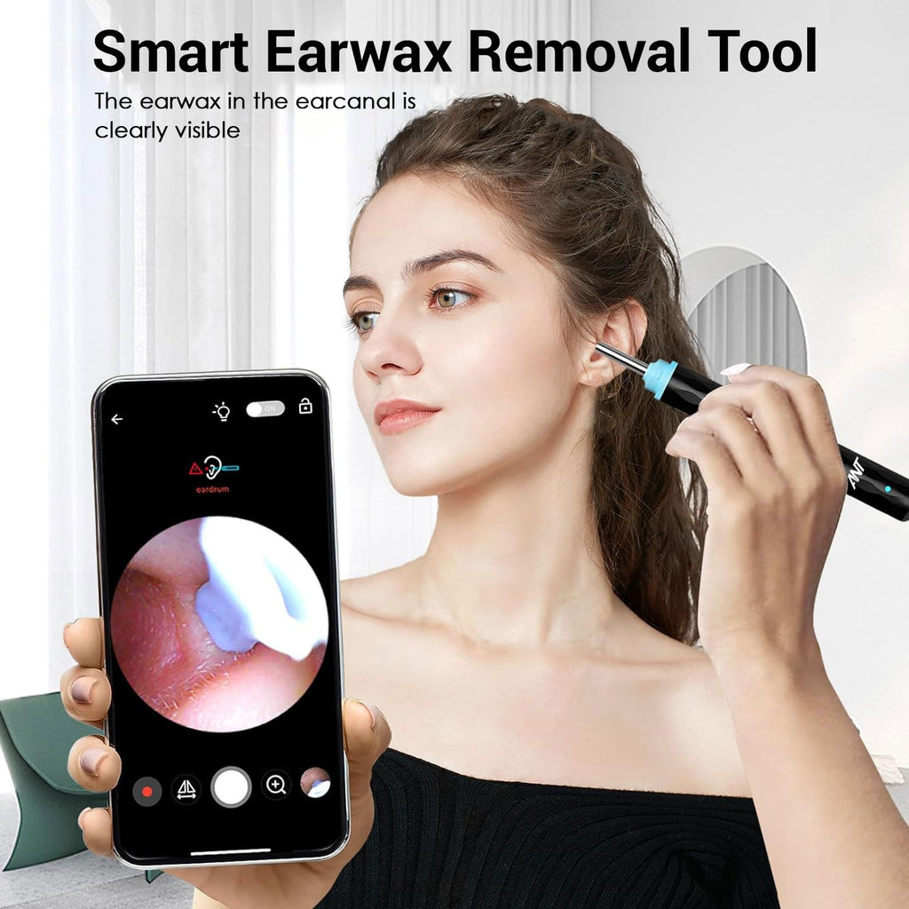 HD Wireless Ear Wax Cleaner Kit with Camera