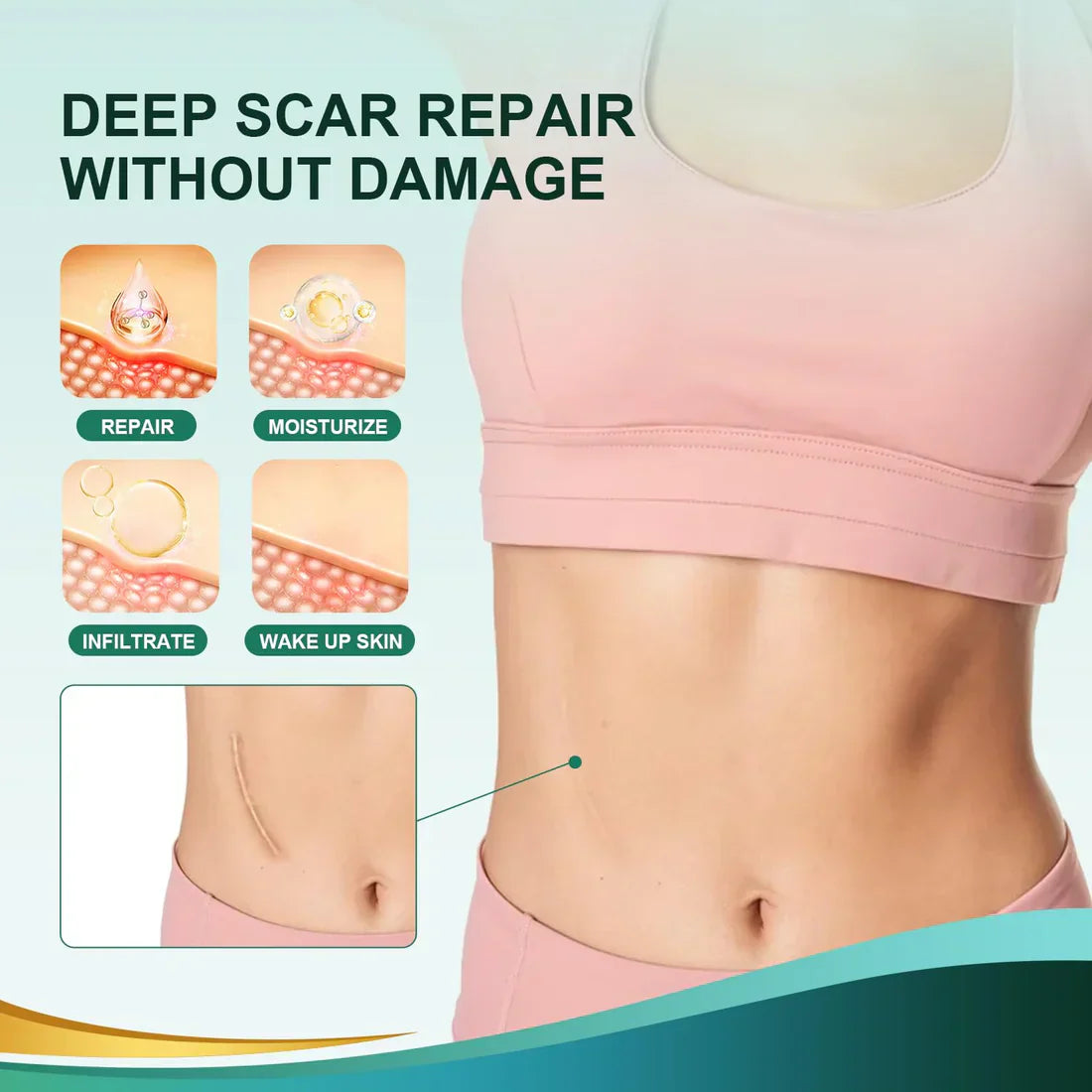 Silicone Scar Remover Tape for Acne & Wrinkles